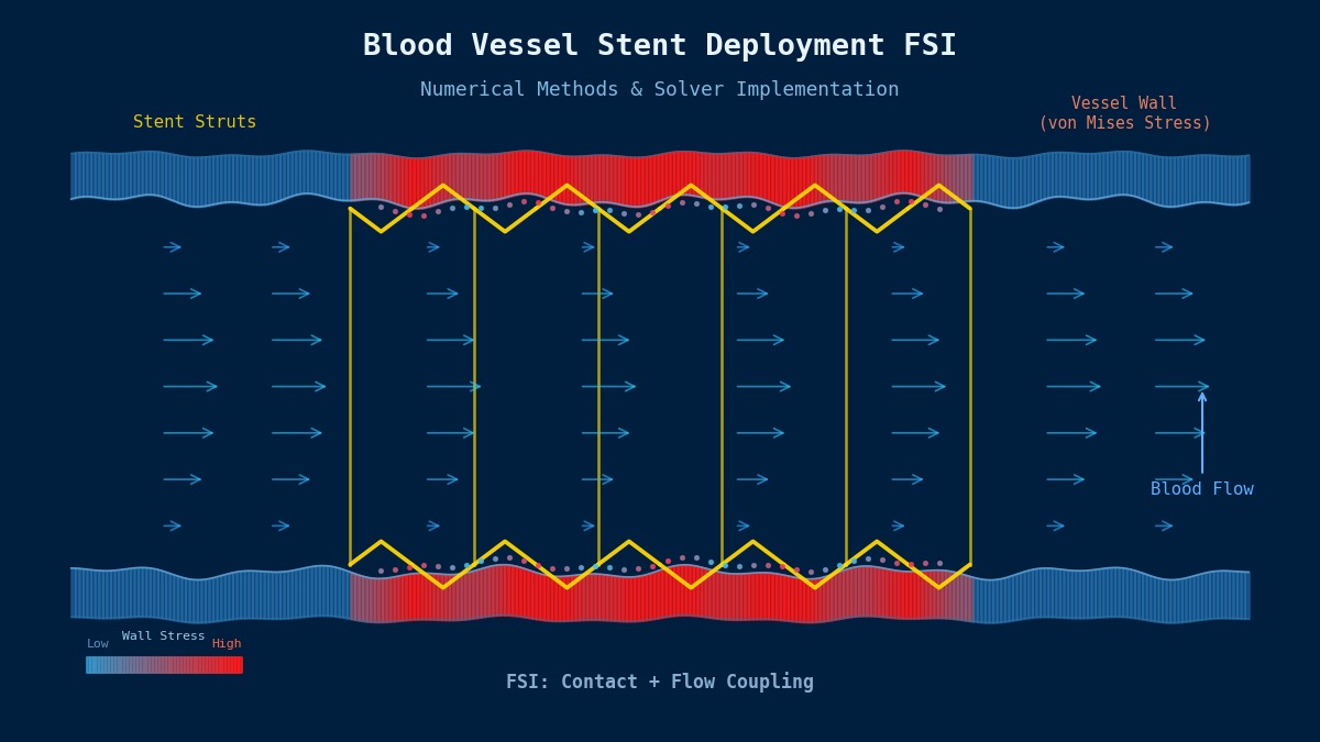 Blood vessel stent deployment FSI simulation showing von Mises wall stress distribution, stent struts, and parabolic blood flow velocity field